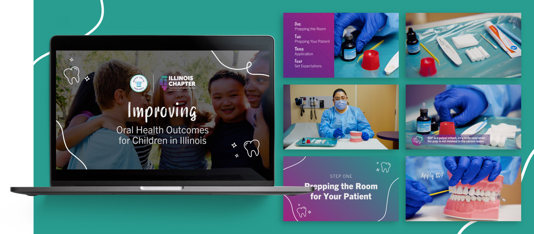 Icaap Oral Health Outcomes Video On Laptop Display Icaap Oral Health Outcomes Video On Laptop Display